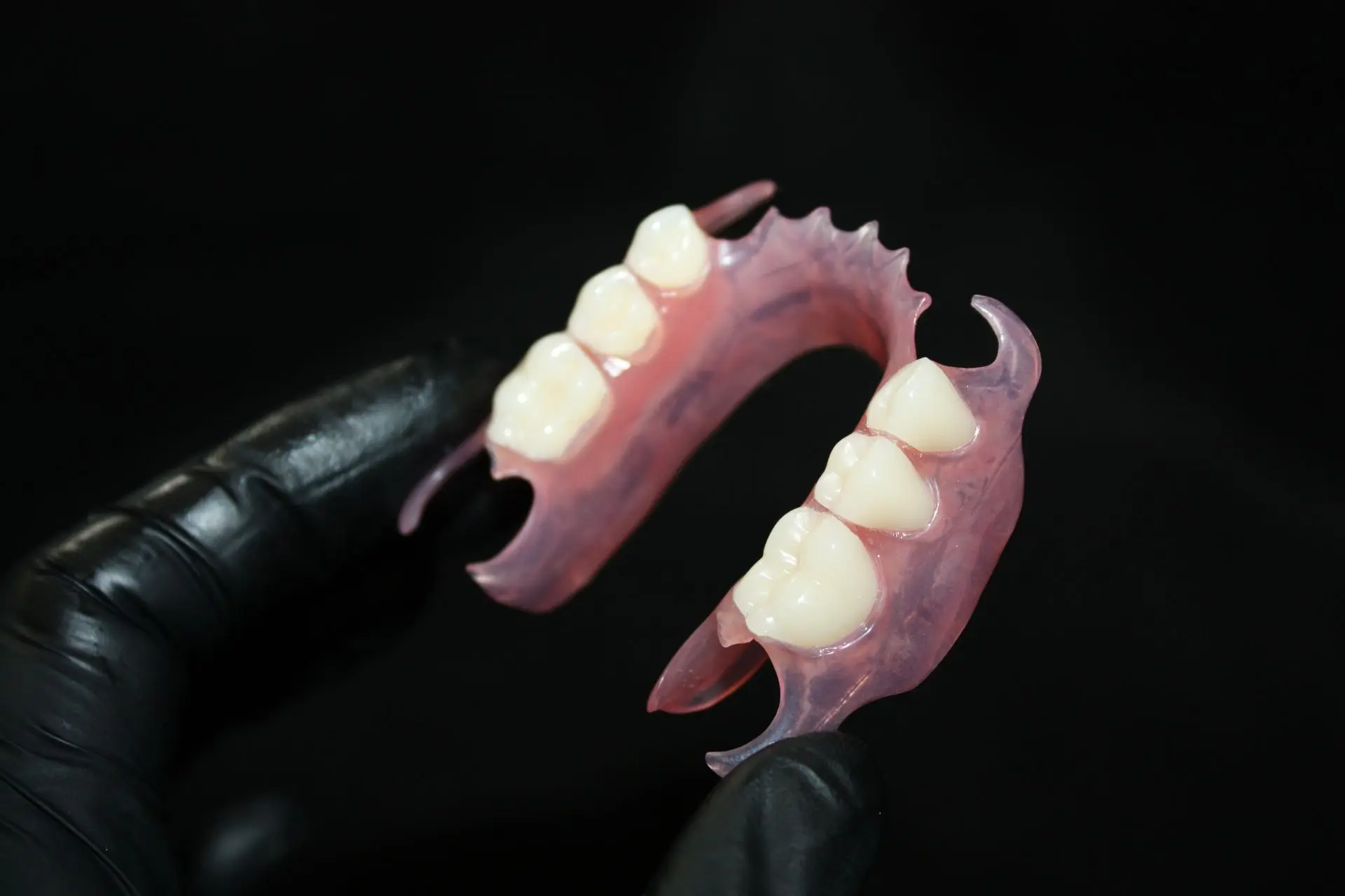 Prothèse adjointe et TCS®