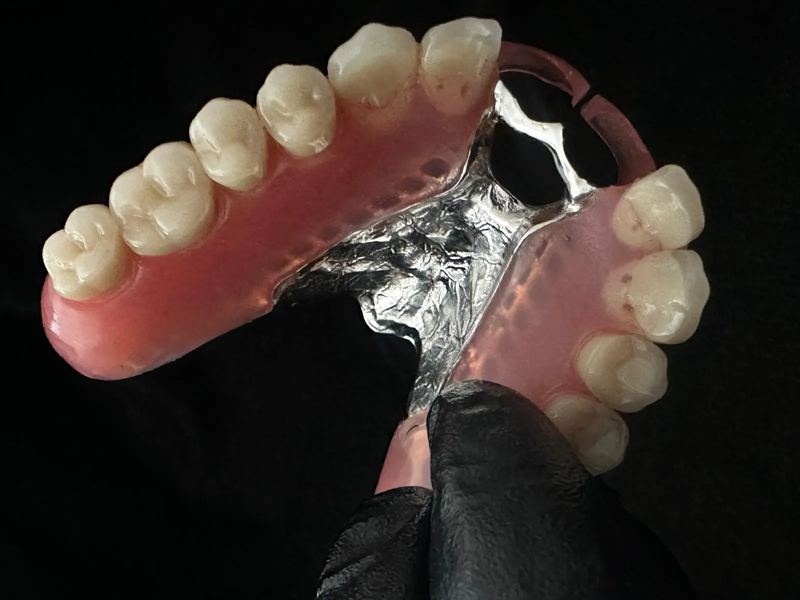 stellite et TCS® Dental connexion