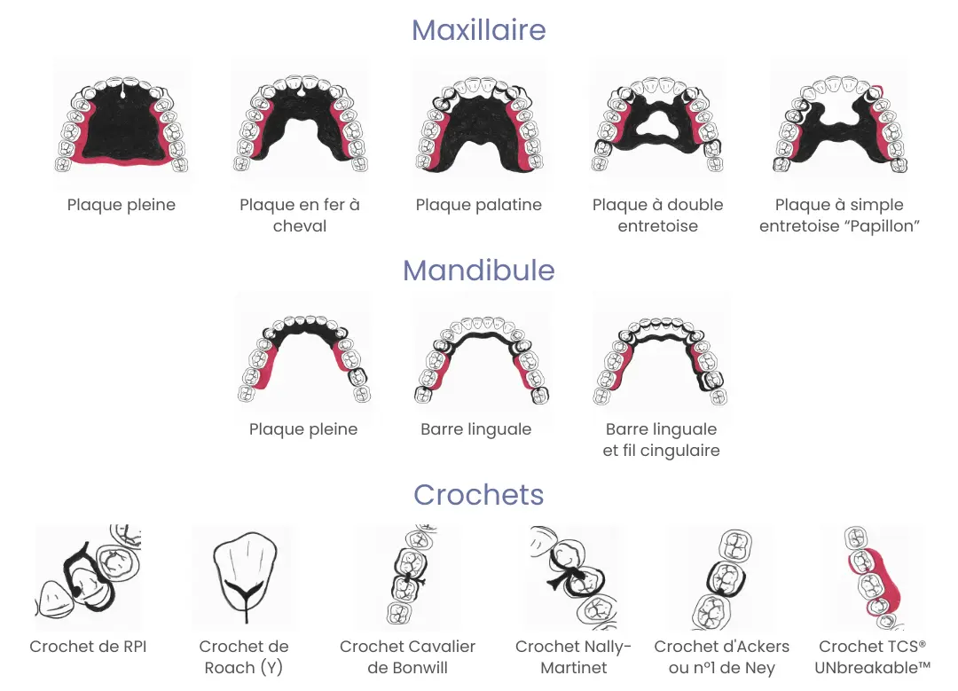 Proposition de tracé de stellite de Dental Connexion