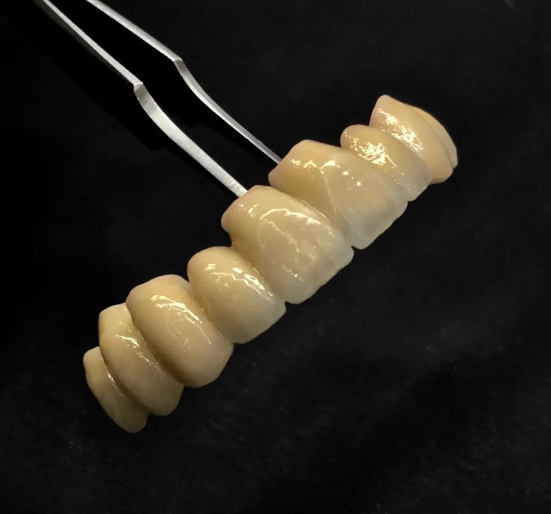 Prothèses Conjointes et Implantologie