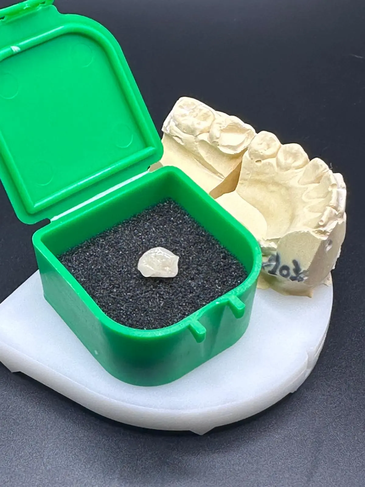 Couronne Emax Dental Connexion