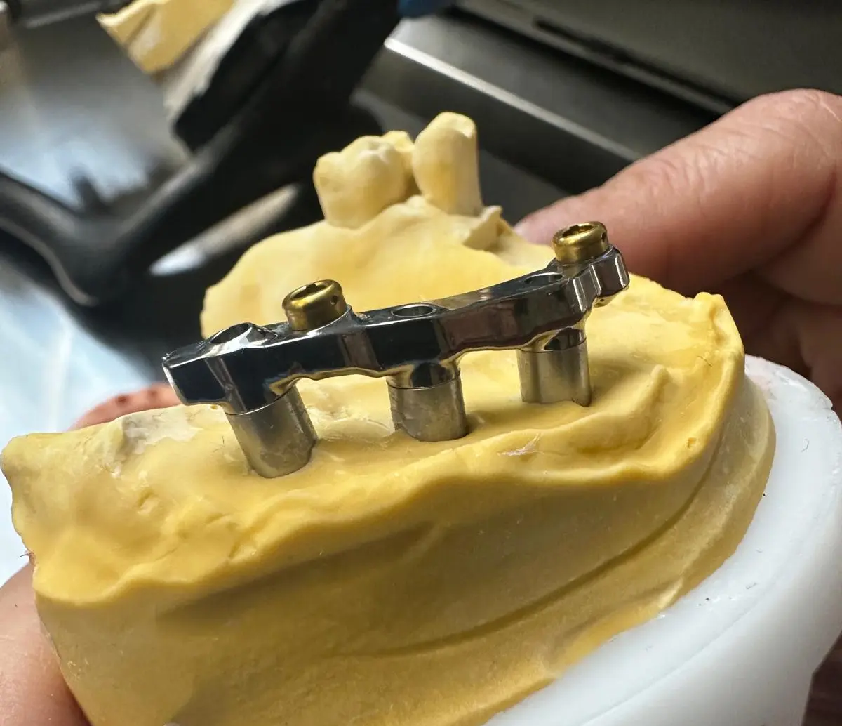 Barre personnalisée Dental Connexion 