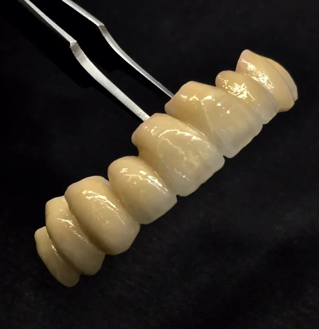 Couronne coulée Dental Connexion