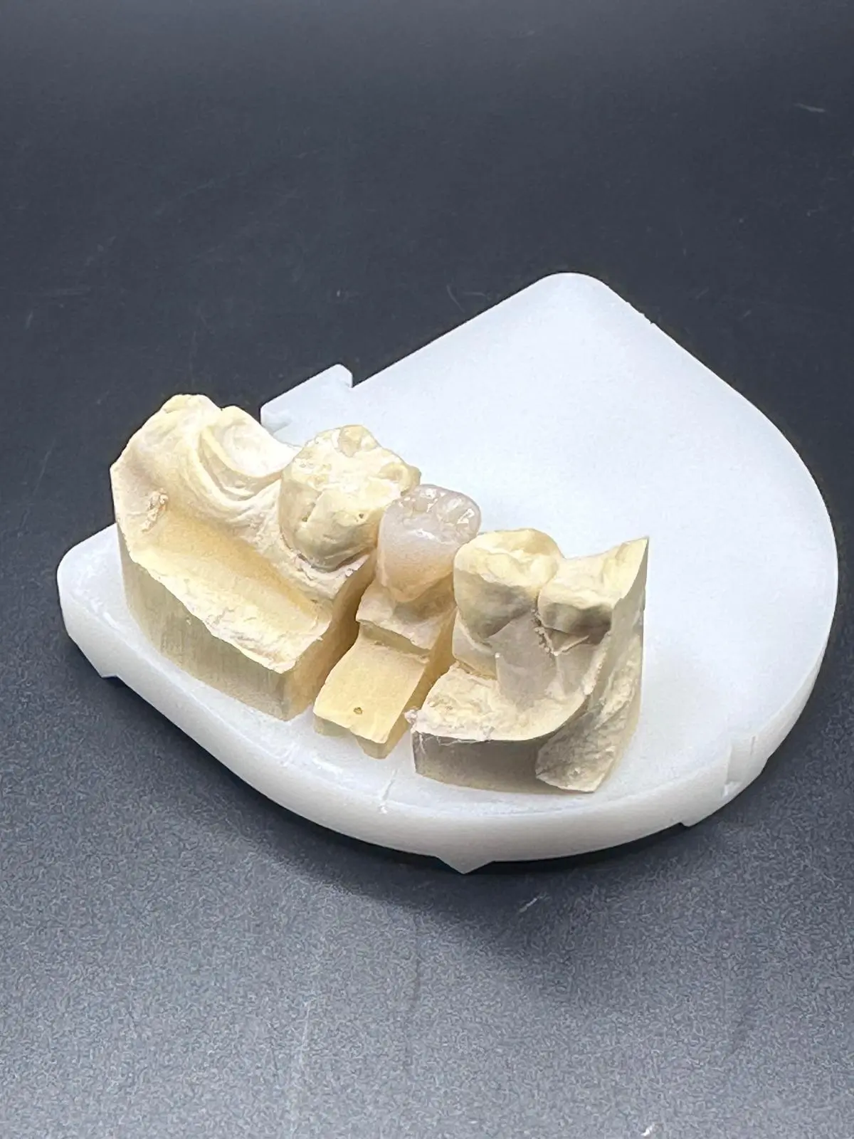 Couronne Full Zircone Dental Connexion