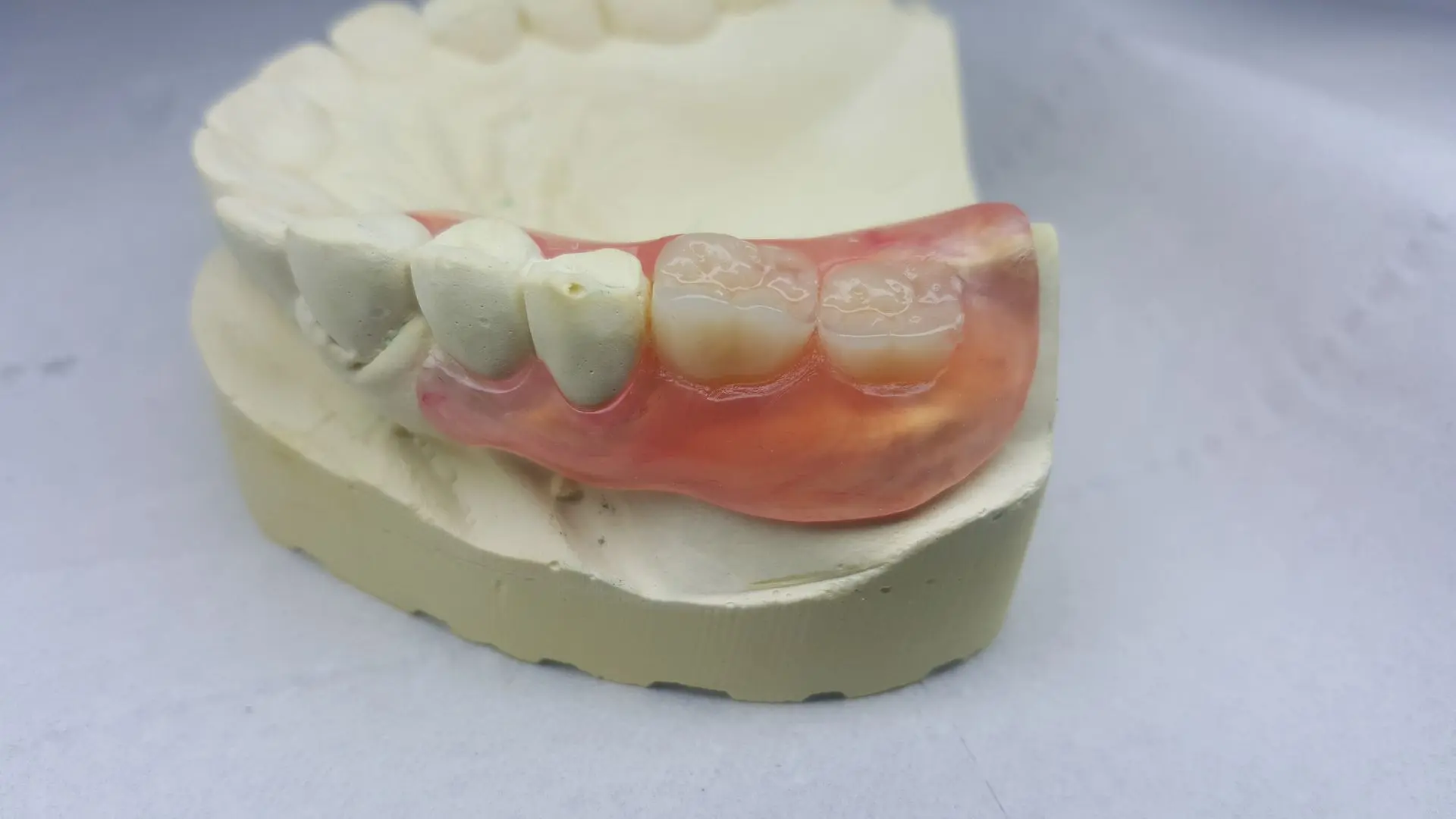 Gamme Adjointe Dental COnnexion