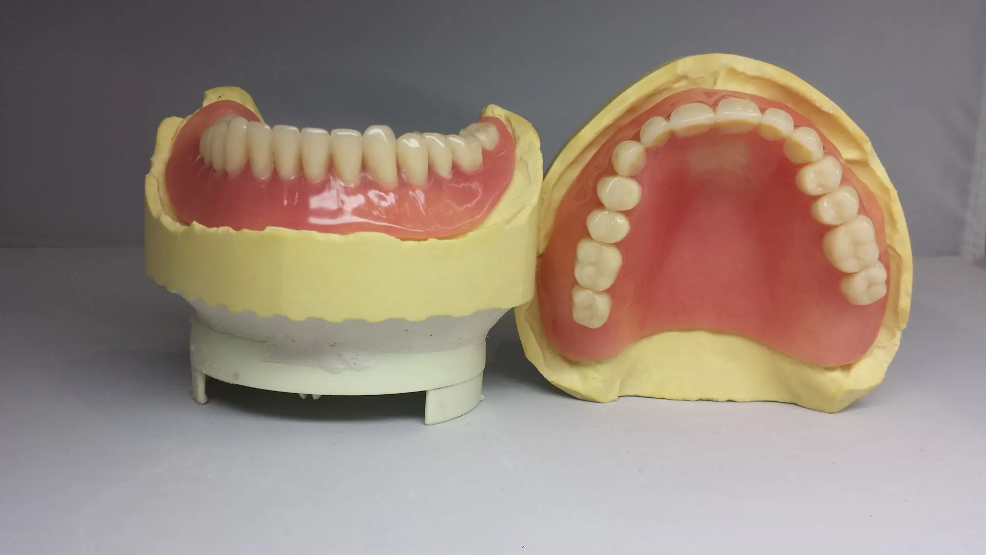 prothèse complète Dental Connexion